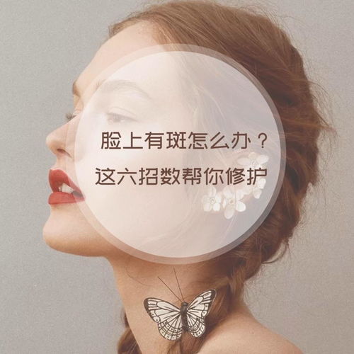 有誰有祛斑成功的經(jīng)歷嗎