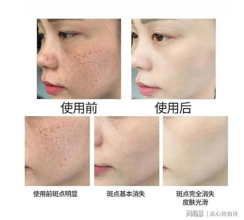 國家唯一認(rèn)證的祛斑產(chǎn)品都有哪個 做好祛斑筆記啦