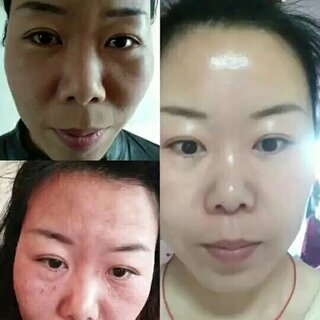 #杏雙祛斑加盟#