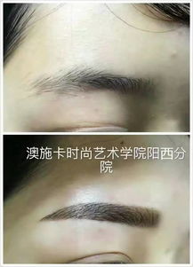 祛斑祛痘新篇章 慶祝翌芙萊專業(yè)祛斑祛痘陽西總店盛大開業(yè)