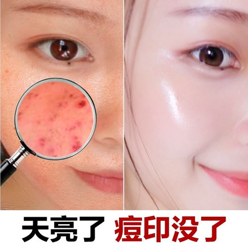 美白祛斑去痘印，素顏霜神仙膏讓肌膚煥然一新