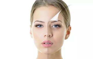 臉頰兩側(cè)長斑的原因與專業(yè)祛斑方法