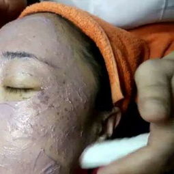 專業(yè)祛斑祛痘技術(shù)研究 科學護膚與實用指南