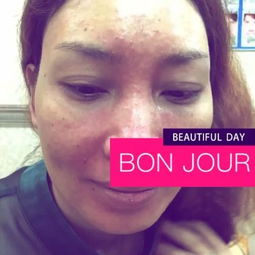 安慶瑤芳專業(yè)祛斑 科學護膚，煥發(fā)肌膚光彩