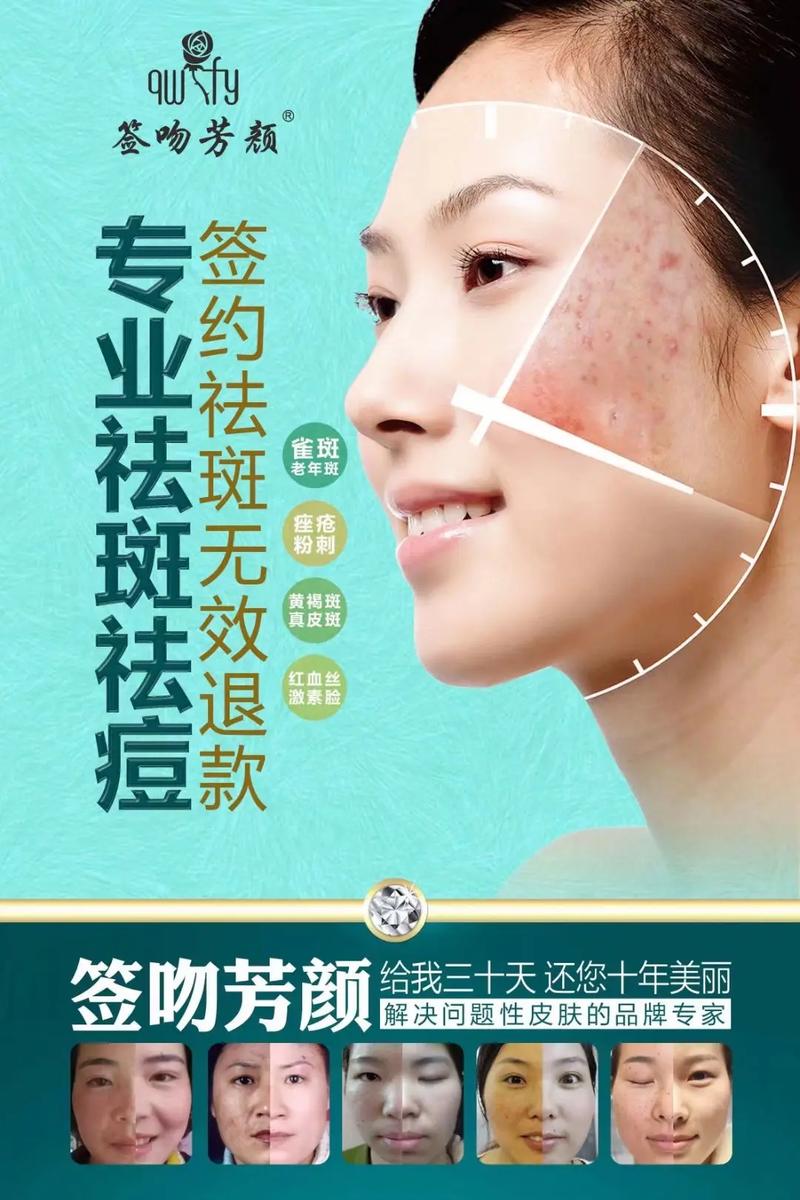 專業祛斑祛痘 純中藥綠色祛斑，二十多年成功經驗