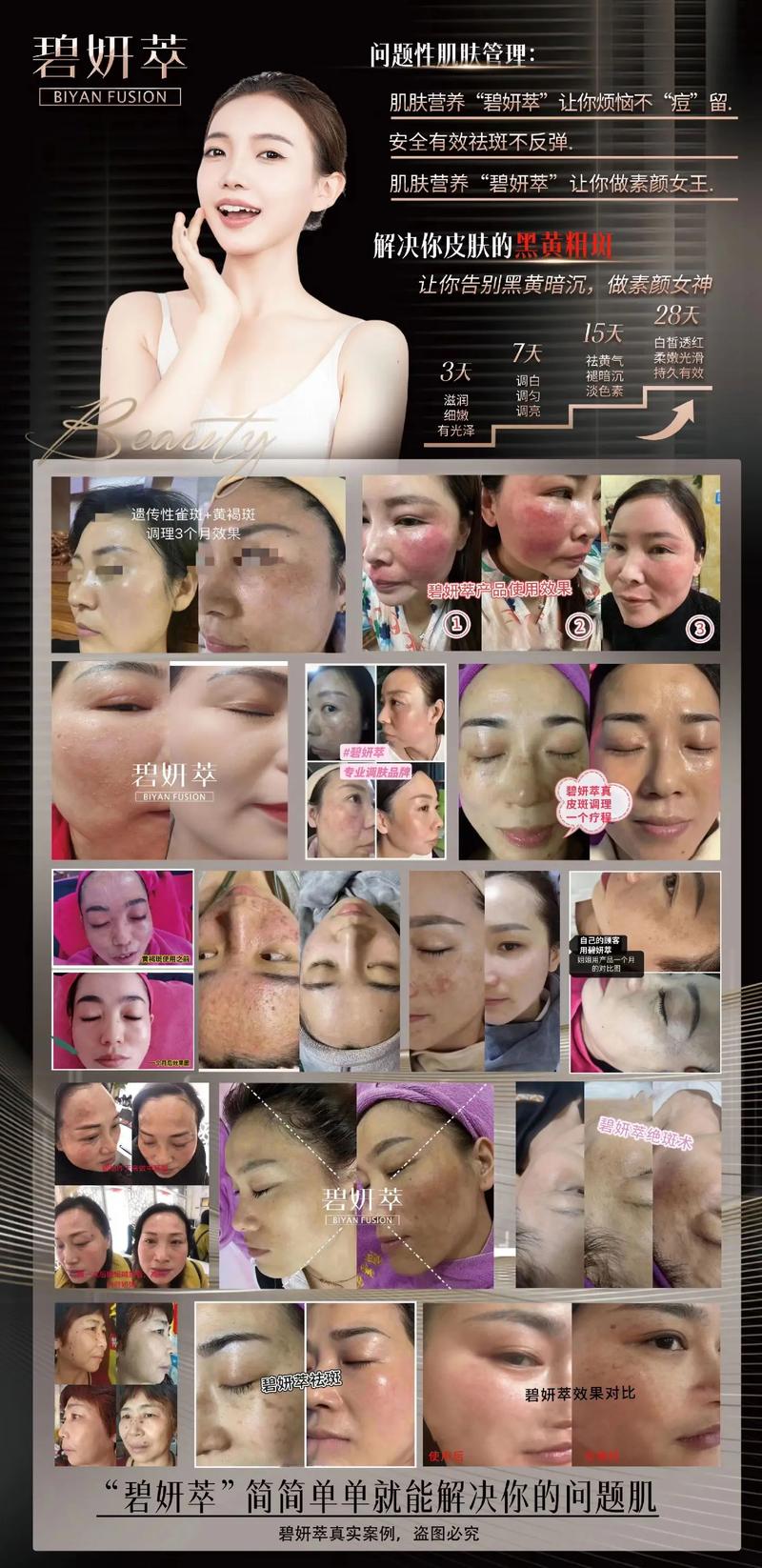 碧妍萃專業調膚祛斑 觀其膚，辯其癥，對癥祛斑的最高境界